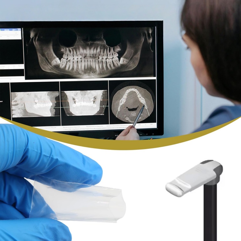 200 pièces/boîte – Manchons de - Photography Dental avis et prix