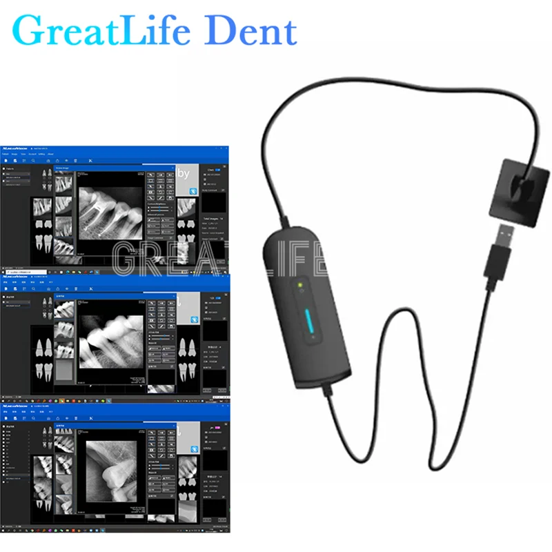 Mexique RU EU ES SA IT en Stoc - Photography Dental avis et prix