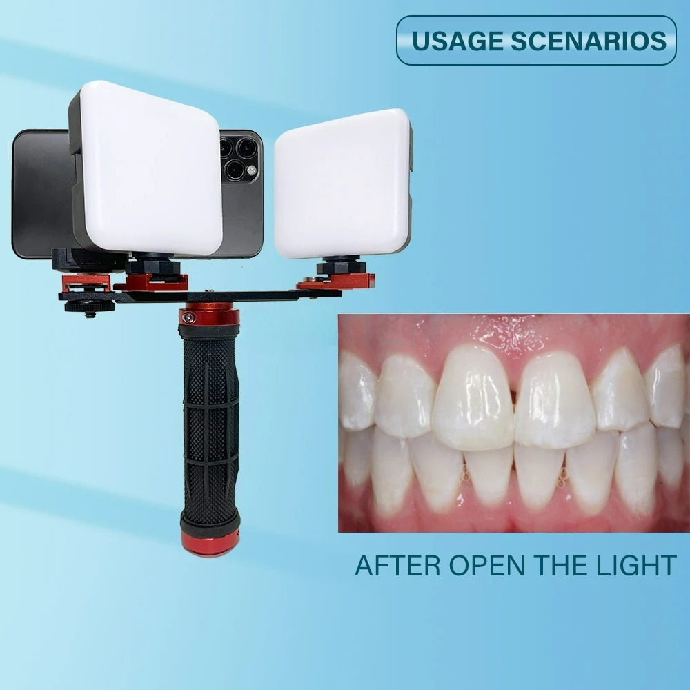 Lampe de photographie dentaire - Photography Dental avis et prix