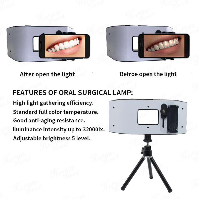 Lampe de poche dentaire, équip - Photography Dental avis et prix