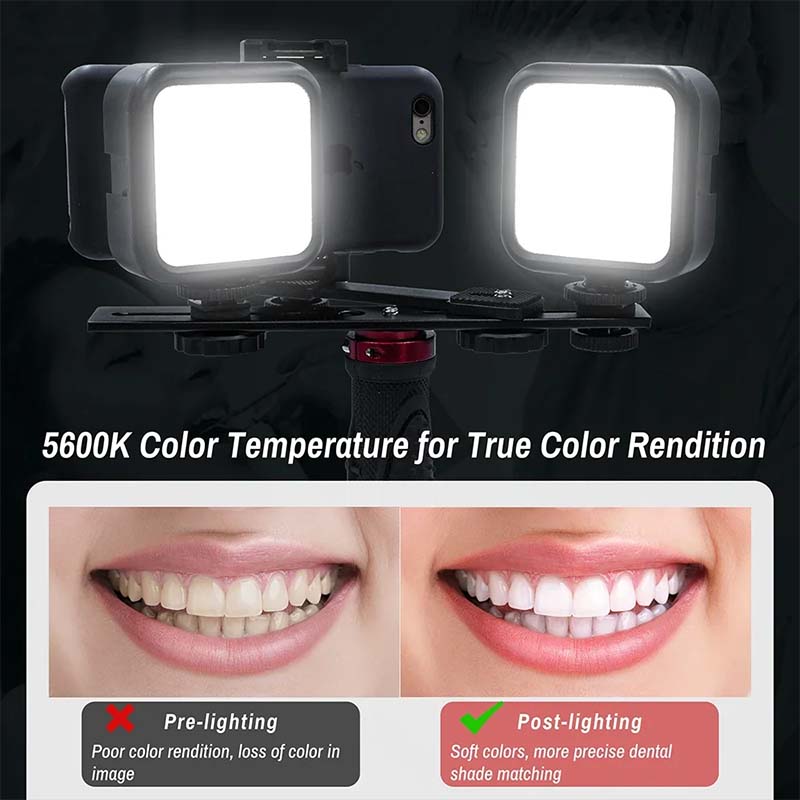 Lumière de photographie dentai - Photography Dental avis et prix